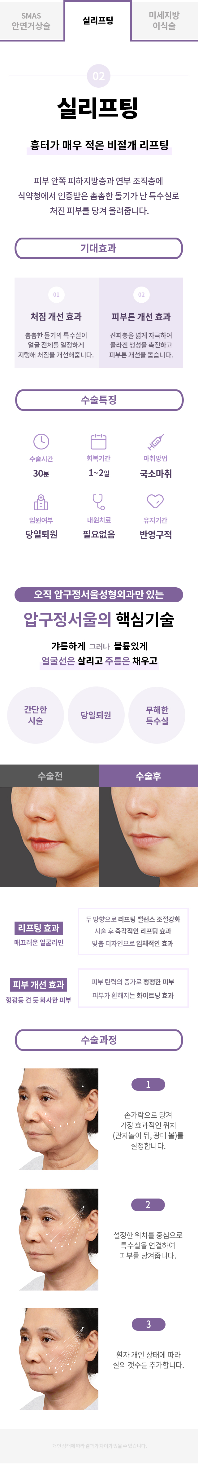 팔자주름_프로모션_페이지2