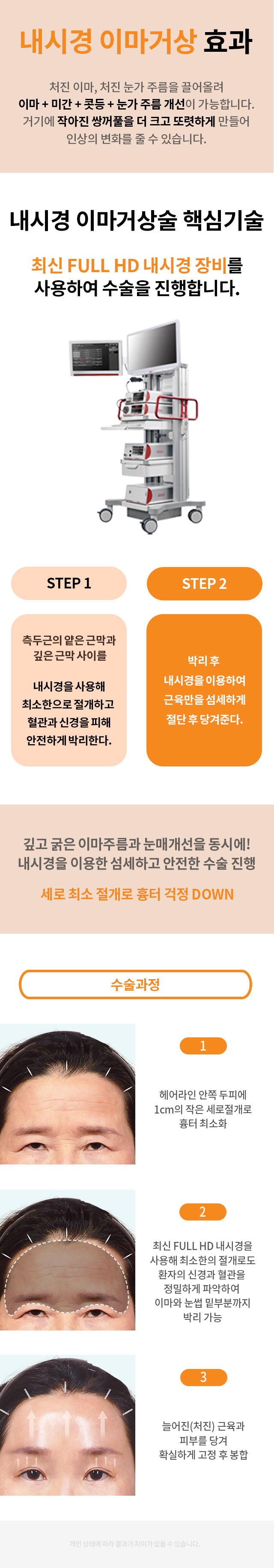 이마거상술_프로모션_페이지