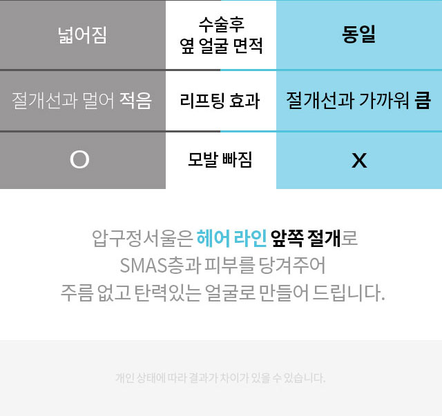 안면거상술_프로모션_페이지