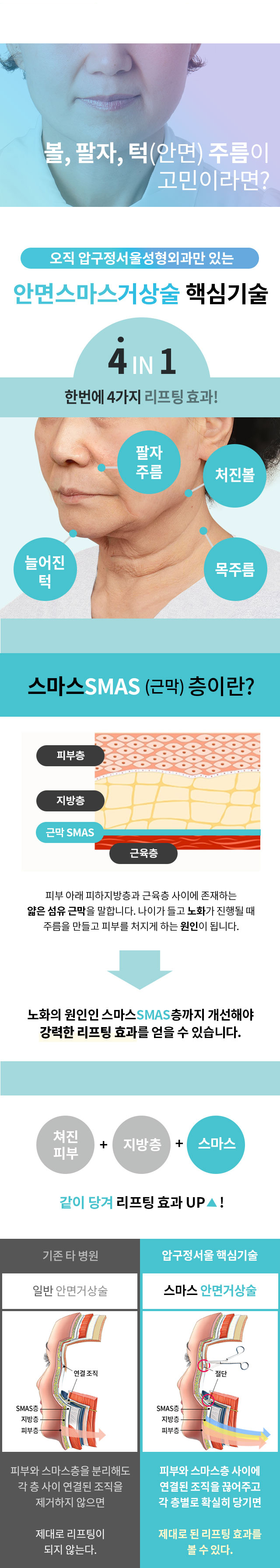 안면거상술_프로모션_페이지