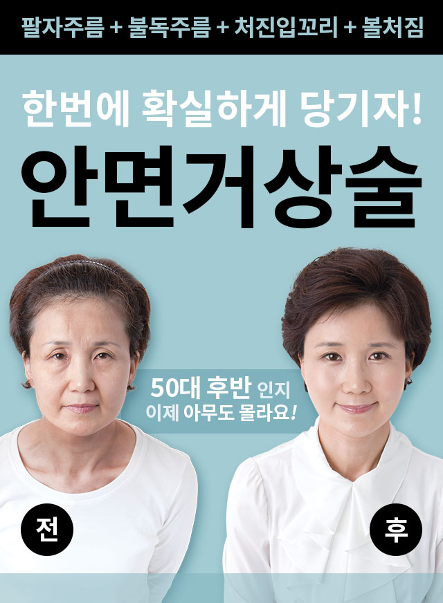 안면거상술_프로모션_페이지