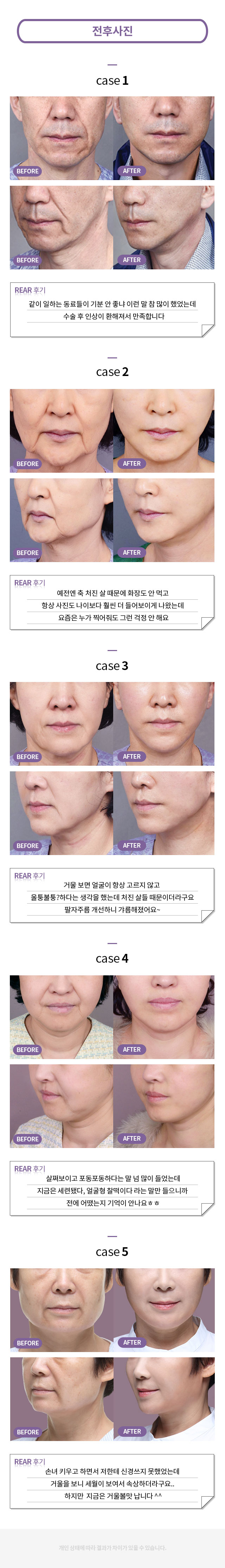 팔자주름_프로모션_페이지